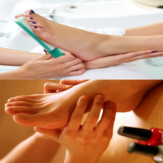 Heelpeel