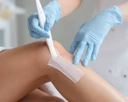 LEG