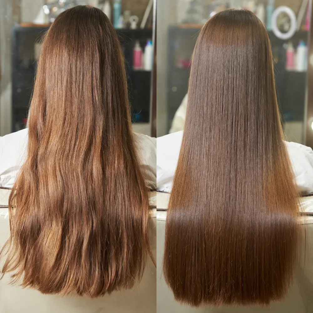 Nutri Plastia ( Per Gram )